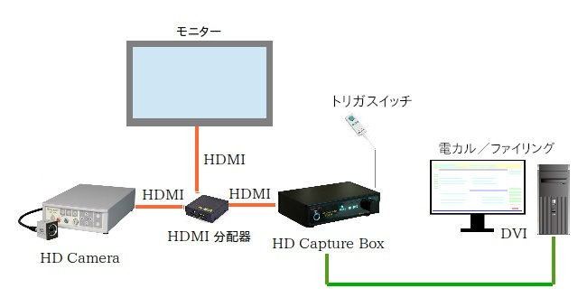 HD Capture Box